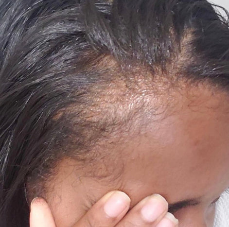 Gazing Green Hair Elixir