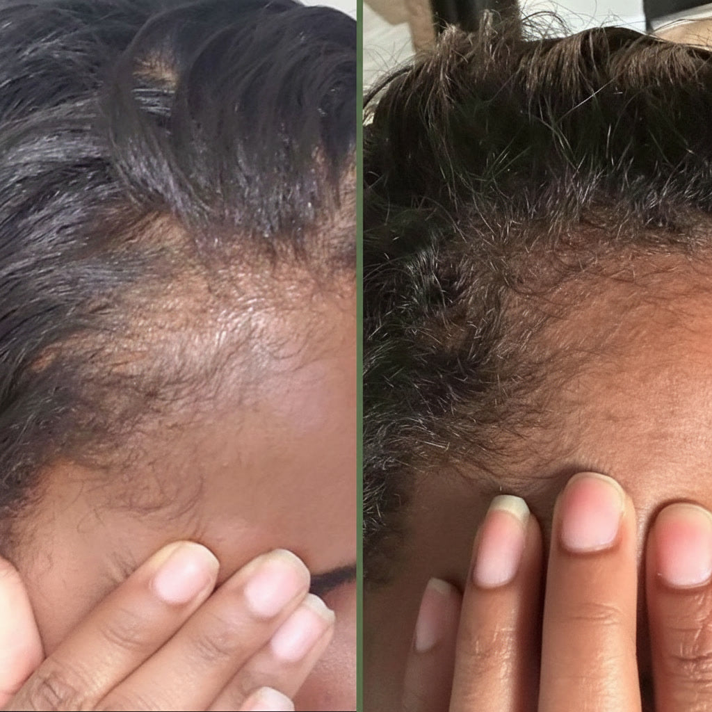 Gazing Green Hair Elixir