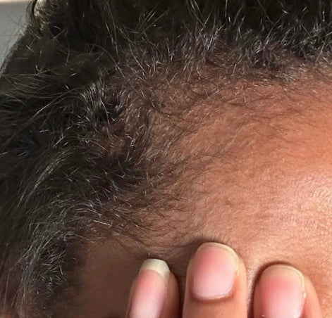 Gazing Green Hair Elixir