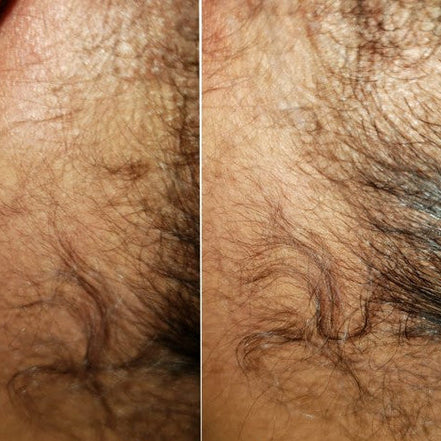 Gazing Green Hair Elixir